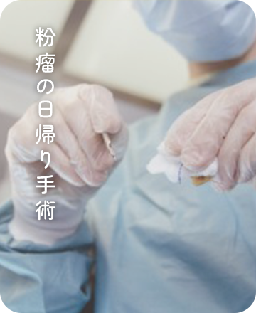 粉瘤の日帰り手術